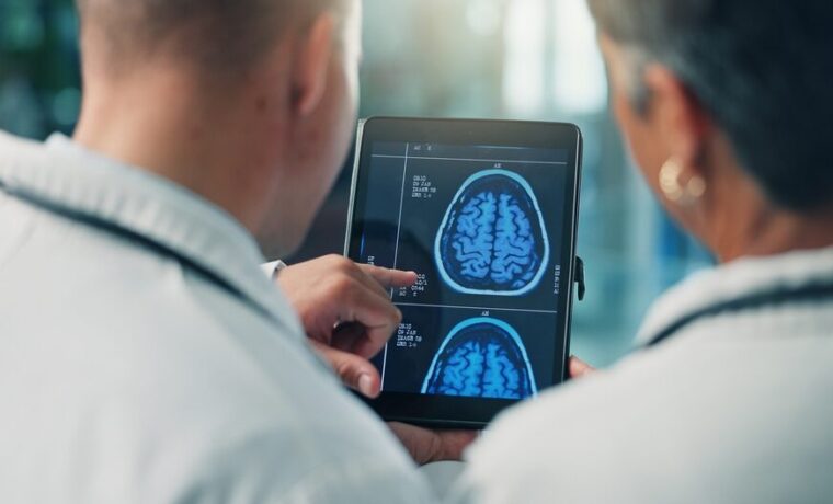 Immagine di un elettrocardiogramma che rappresenta la fibrillazione atriale
